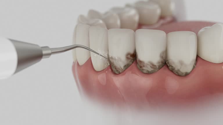 Reliable Dental Implants contractor in Three Oaks, MI by Smile Center Dentistry